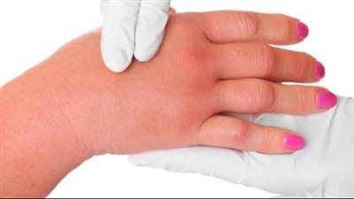 كيف تتخلص من الأملاح الزائدة في جسمك؟